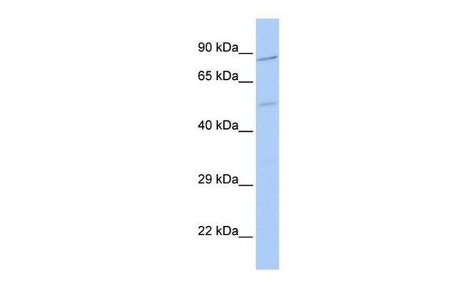 ZNF585B Antibody in Western Blot (WB)