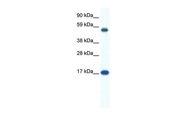 ZNF554 Antibody in Western Blot (WB)