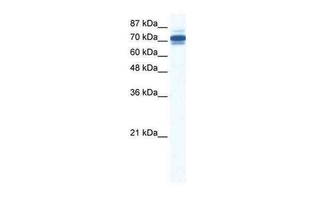 ZNF690 Antibody in Western Blot (WB)