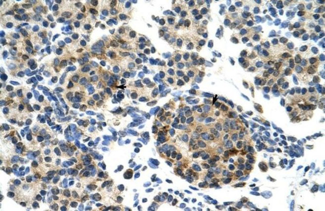 ZNF555 Antibody in Immunohistochemistry (IHC)
