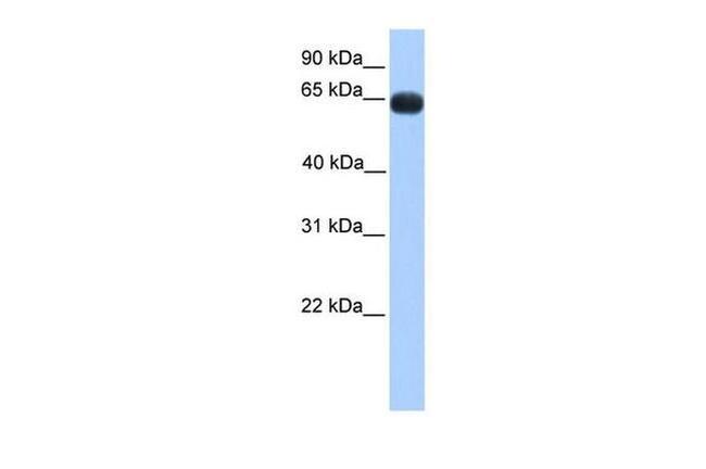 ZNF100 Antibody in Western Blot (WB)
