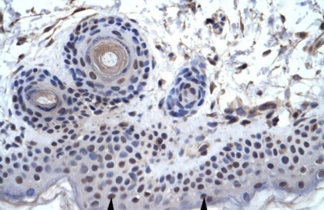 ZNF660 Antibody in Immunohistochemistry (IHC)