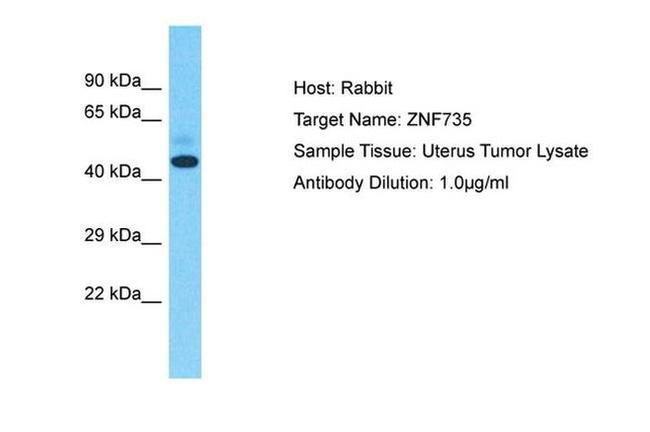 ZNF735 Antibody in Western Blot (WB)