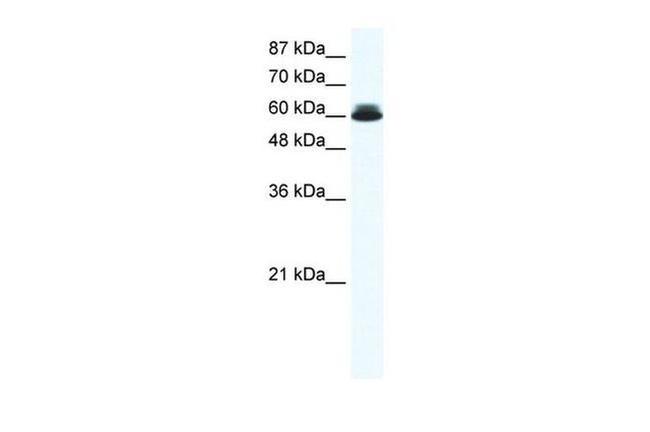 DDX27 Antibody in Western Blot (WB)