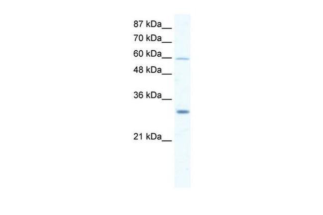 DDX31 Antibody in Western Blot (WB)