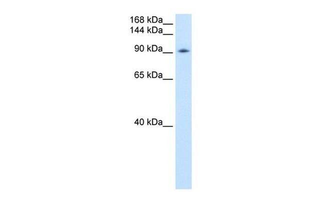 DDX54 Antibody in Western Blot (WB)