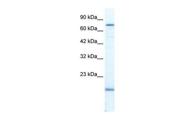 PGBD3 Antibody in Western Blot (WB)