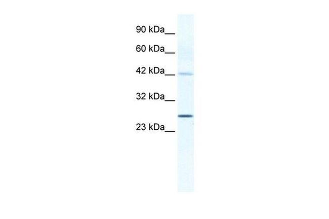 Connexin 30.3 Antibody in Western Blot (WB)