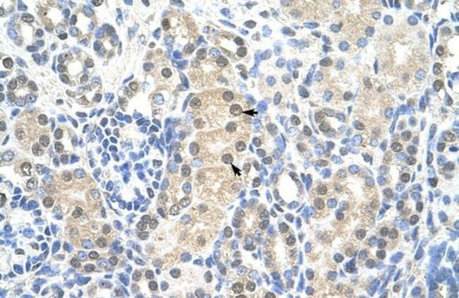 MCM7 Antibody in Immunohistochemistry (IHC)