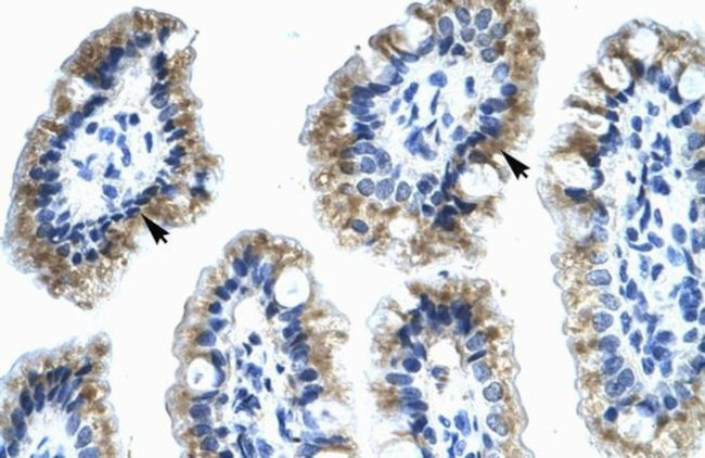 Annexin A4 Antibody in Immunohistochemistry (IHC)