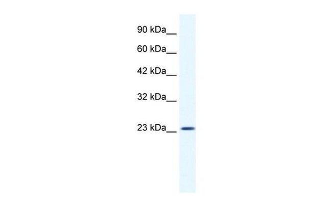 KCTD11 Antibody in Western Blot (WB)