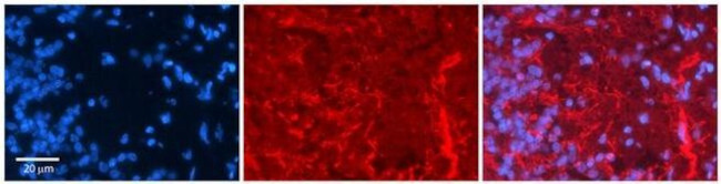 GRIK5 Antibody in Immunohistochemistry (Paraffin) (IHC (P))