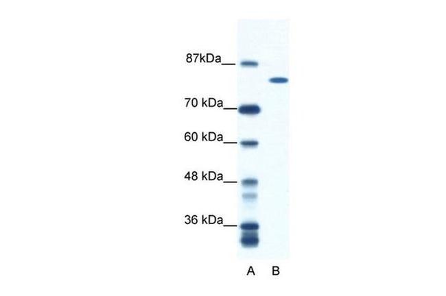 DHX16 Antibody in Western Blot (WB)