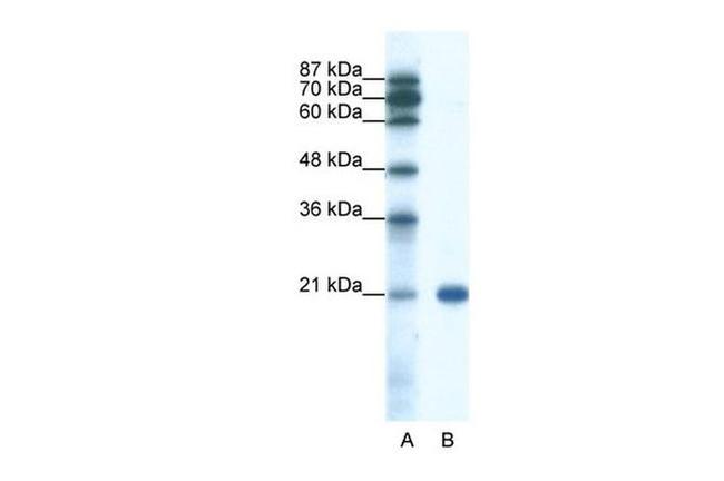SSX2 Antibody in Western Blot (WB)