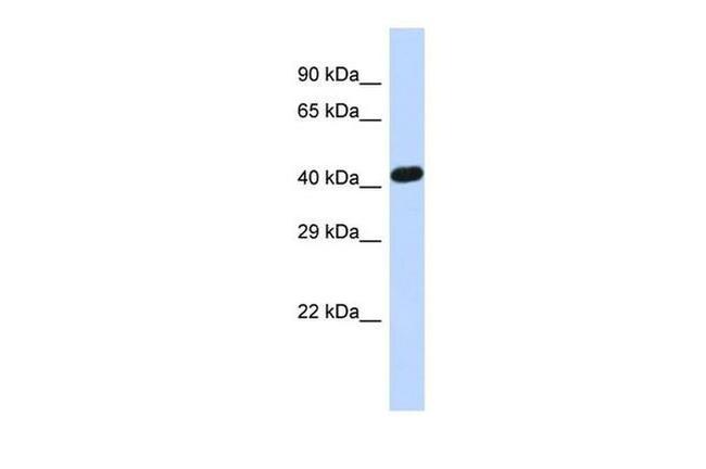 ZNF773 Antibody in Western Blot (WB)