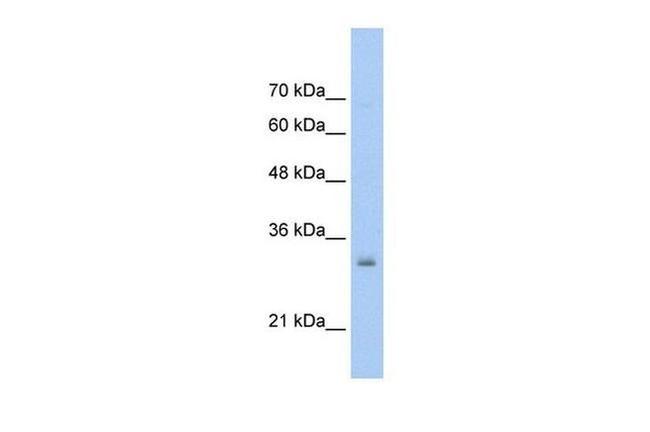 HMGN5 Antibody in Western Blot (WB)