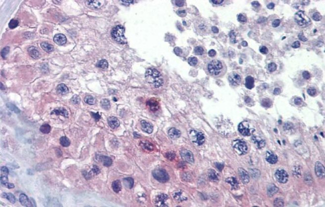 RHOXF2 Antibody in Immunohistochemistry (IHC)