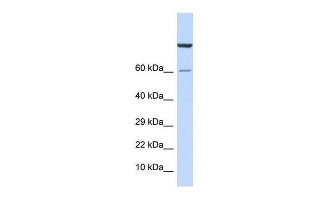 ZNF251 Antibody in Western Blot (WB)