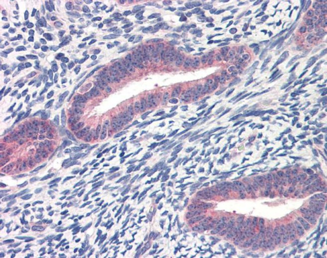 TWIST1 Antibody in Immunohistochemistry (IHC)