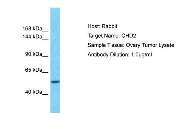 CHD2 Antibody in Western Blot (WB)