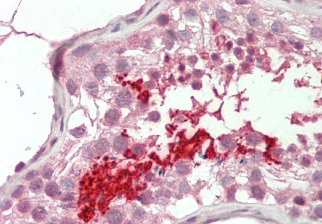 BRDT Antibody in Immunohistochemistry (Paraffin) (IHC (P))