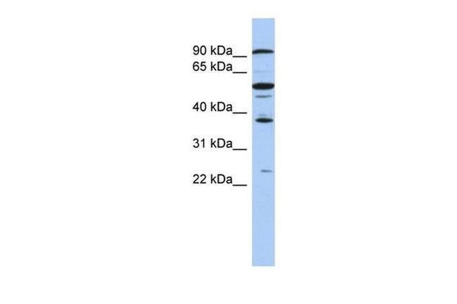 EZH1 Antibody in Western Blot (WB)