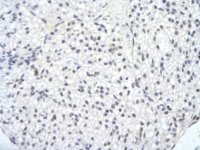 SMARCA1 Antibody in Immunohistochemistry (Paraffin) (IHC (P))