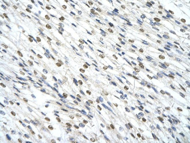 SMARCD2 Antibody in Immunohistochemistry (Paraffin) (IHC (P))