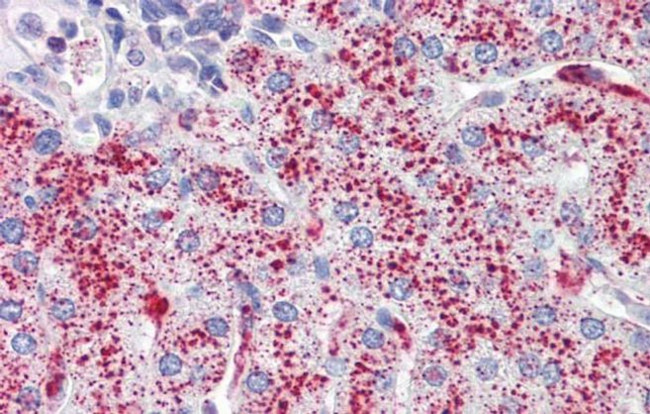 SP4 Antibody in Immunohistochemistry (IHC)
