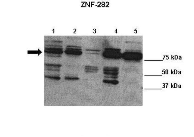 ZNF282 Antibody in Western Blot (WB)