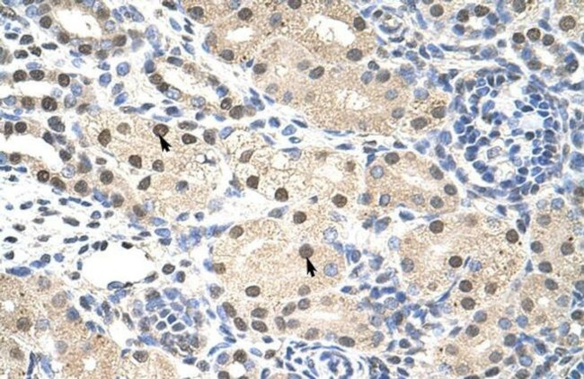 RNF14 Antibody in Immunohistochemistry (IHC)