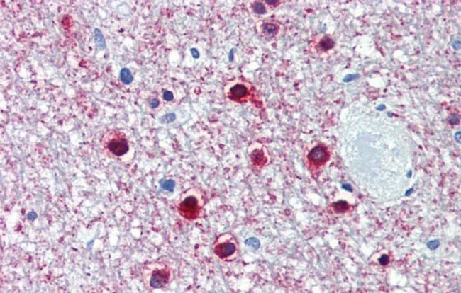 HNF6 Antibody in Immunohistochemistry (IHC)