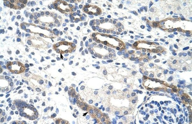 OVOL1 Antibody in Immunohistochemistry (IHC)