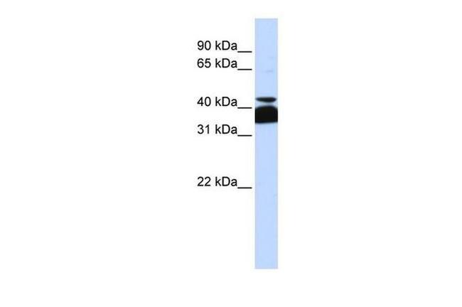 POU4F2 Antibody in Western Blot (WB)