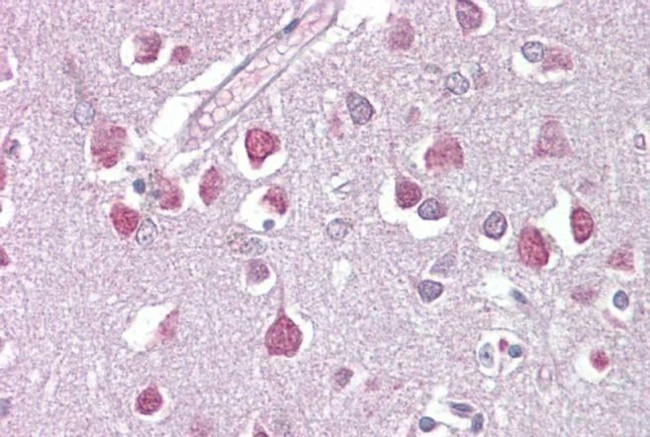 ETV1 Antibody in Immunohistochemistry (IHC)