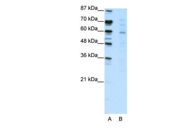 MTG16 Antibody in Western Blot (WB)