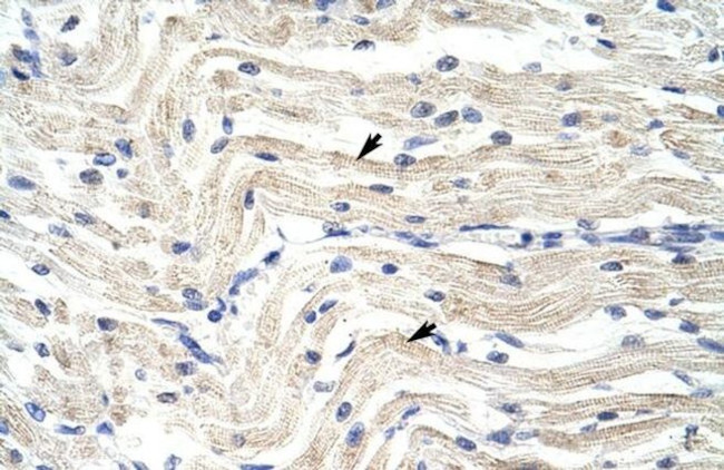 ELL Antibody in Immunohistochemistry (IHC)