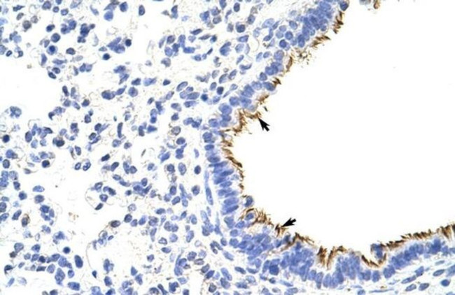 ZNF16 Antibody in Immunohistochemistry (IHC)