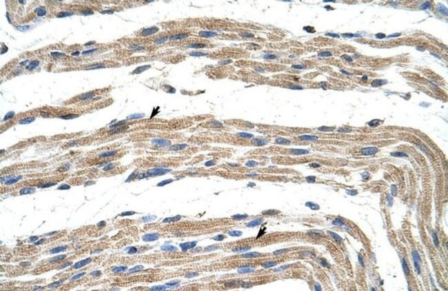 ZNF197 Antibody in Immunohistochemistry (IHC)