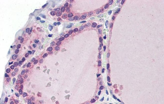 LDOC1 Antibody in Immunohistochemistry (IHC)