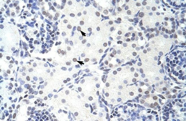 GMEB2 Antibody in Immunohistochemistry (Paraffin) (IHC (P))