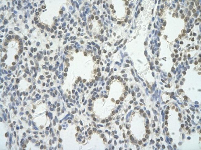 BRD7 Antibody in Immunohistochemistry (Paraffin) (IHC (P))