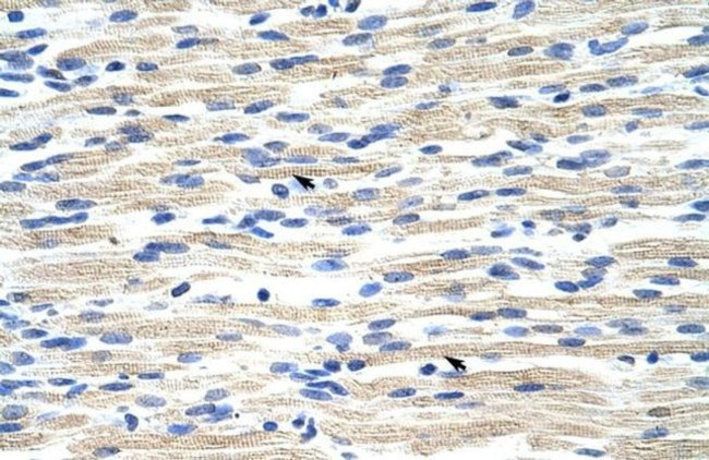 CBX6 Antibody in Immunohistochemistry (IHC)