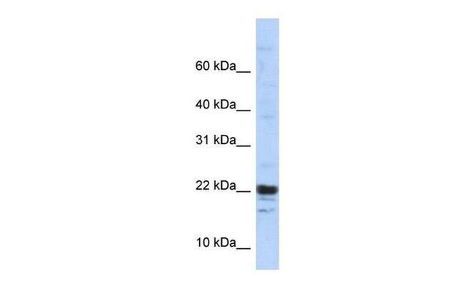 KIAA0040 Antibody in Western Blot (WB)