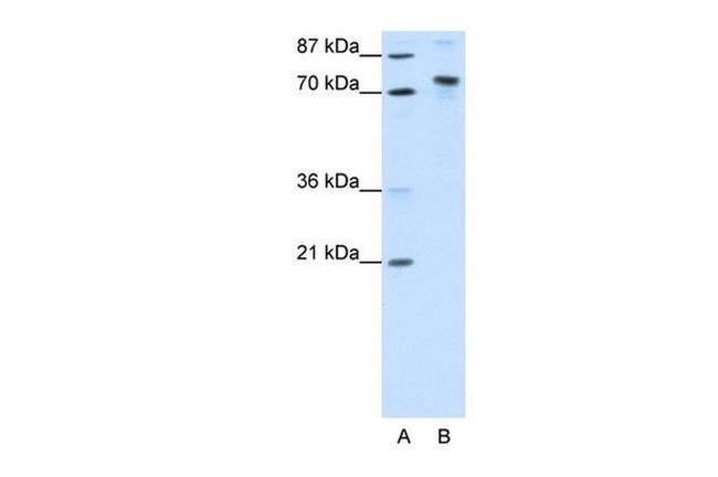 TOX4 Antibody in Western Blot (WB)