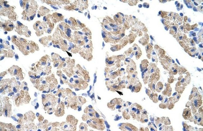 TLX2 Antibody in Immunohistochemistry (IHC)