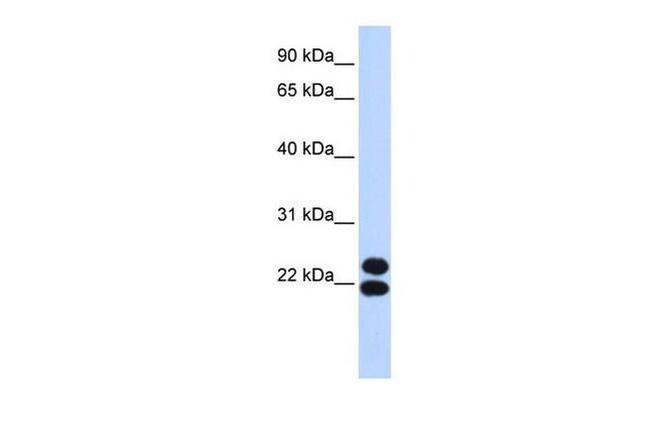 PRRX2 Antibody in Western Blot (WB)