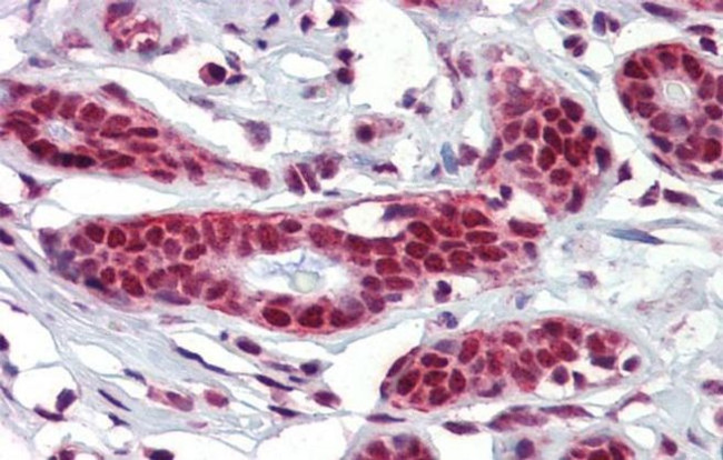 NKRF Antibody in Immunohistochemistry (IHC)