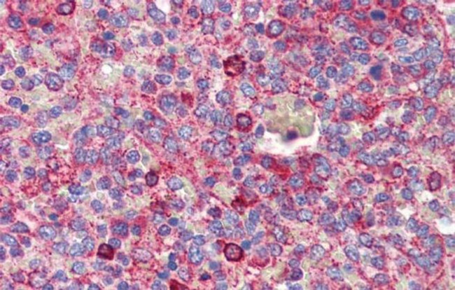 BCL11A Antibody in Immunohistochemistry (IHC)