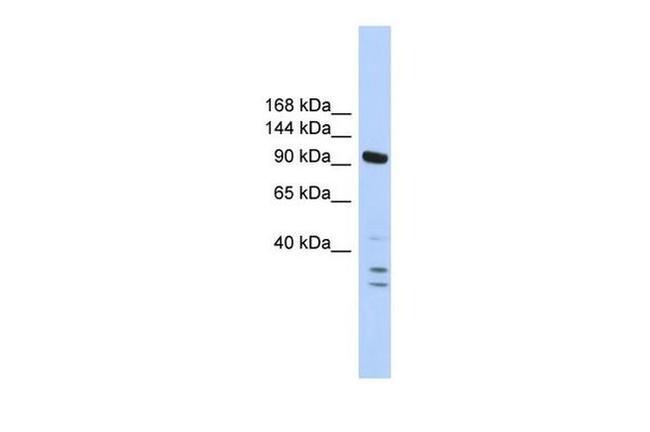 PBRM1 Antibody in Western Blot (WB)